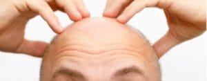 Hairtec Blog 2