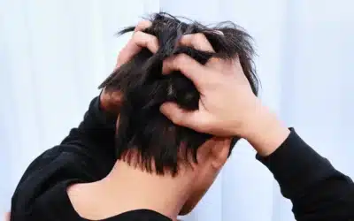 Jeuk na een haartransplantatie