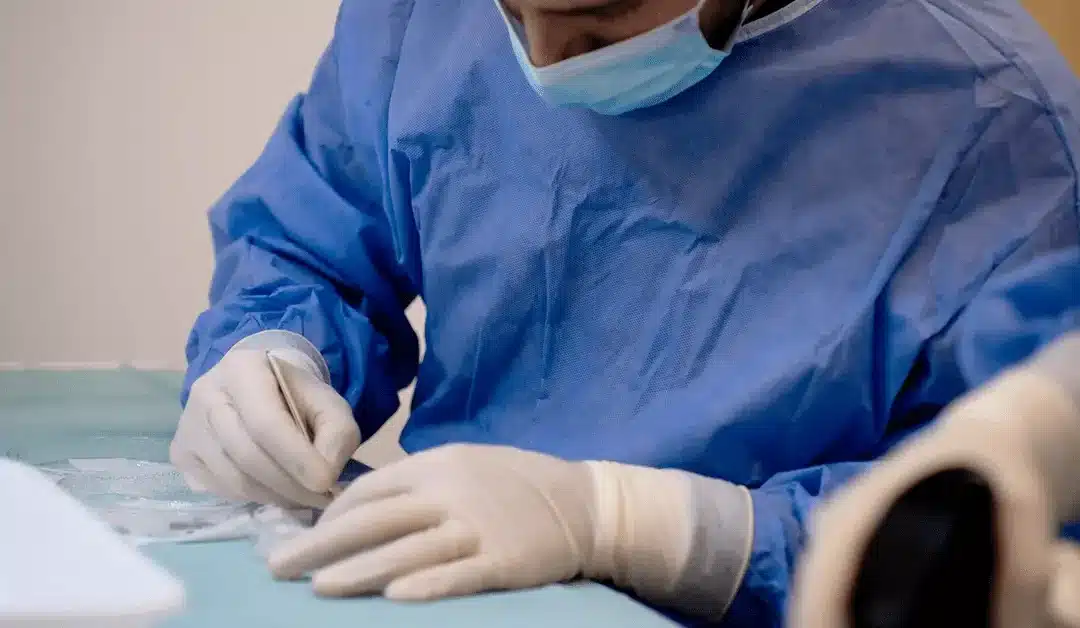 Is een haartransplantatie permanent?