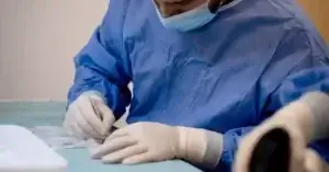 is een haartransplantatie permanent