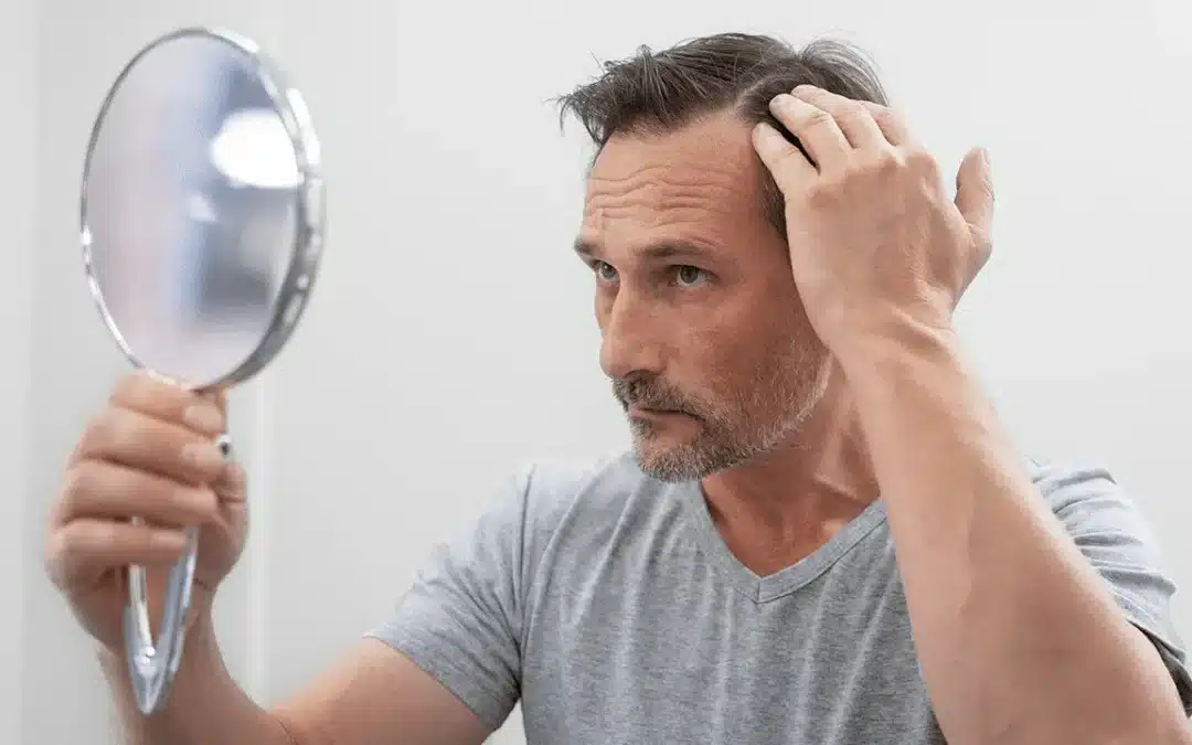 Wat te doen tegen haaruitval? 15 tips die u kunt toepassen