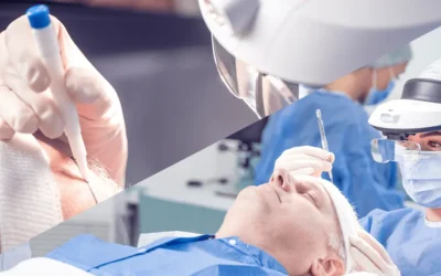 De drie meest toegepaste haartransplantatietechnieken in detail