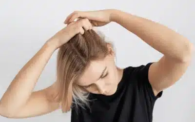Jeukende hoofdhuid en haaruitval bij vrouwen: oorzaken en behandelingen