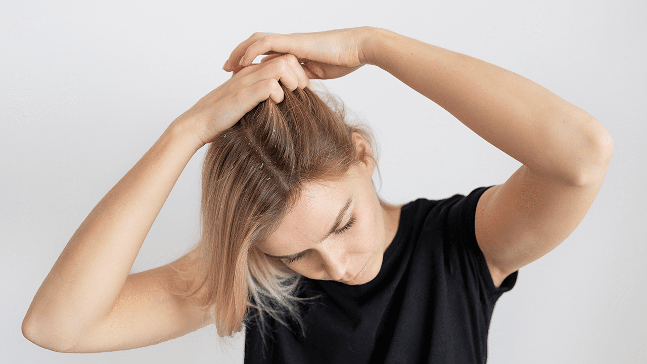 Een jeukende vrouw die haar hoofd krabt