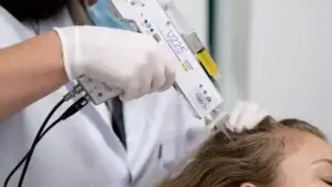 mesotherapie nadelen