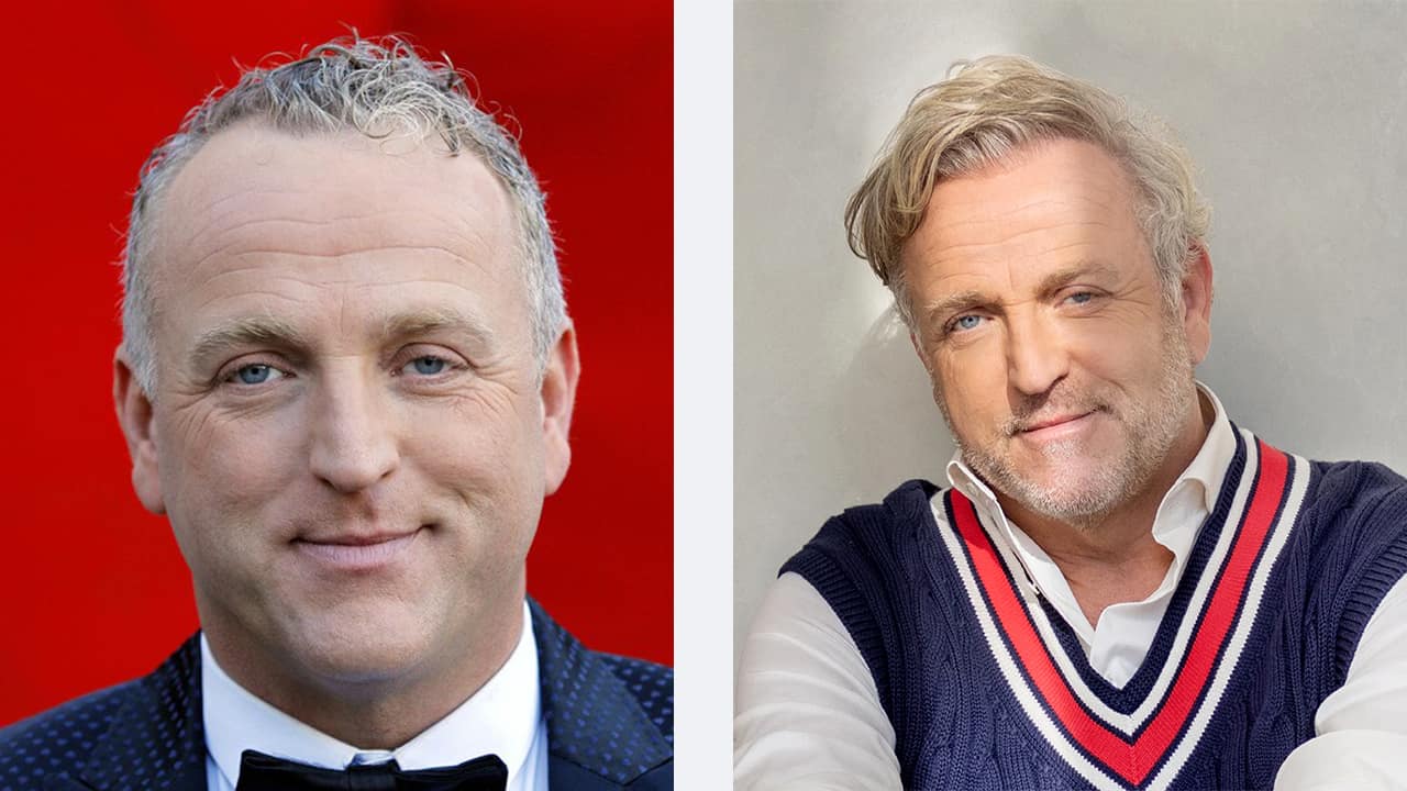 heeft gordon haartransplantatie voor en na