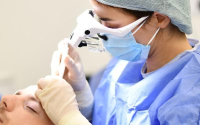 Hoe werkt een haartransplantatie? Stappenplan & uitleg