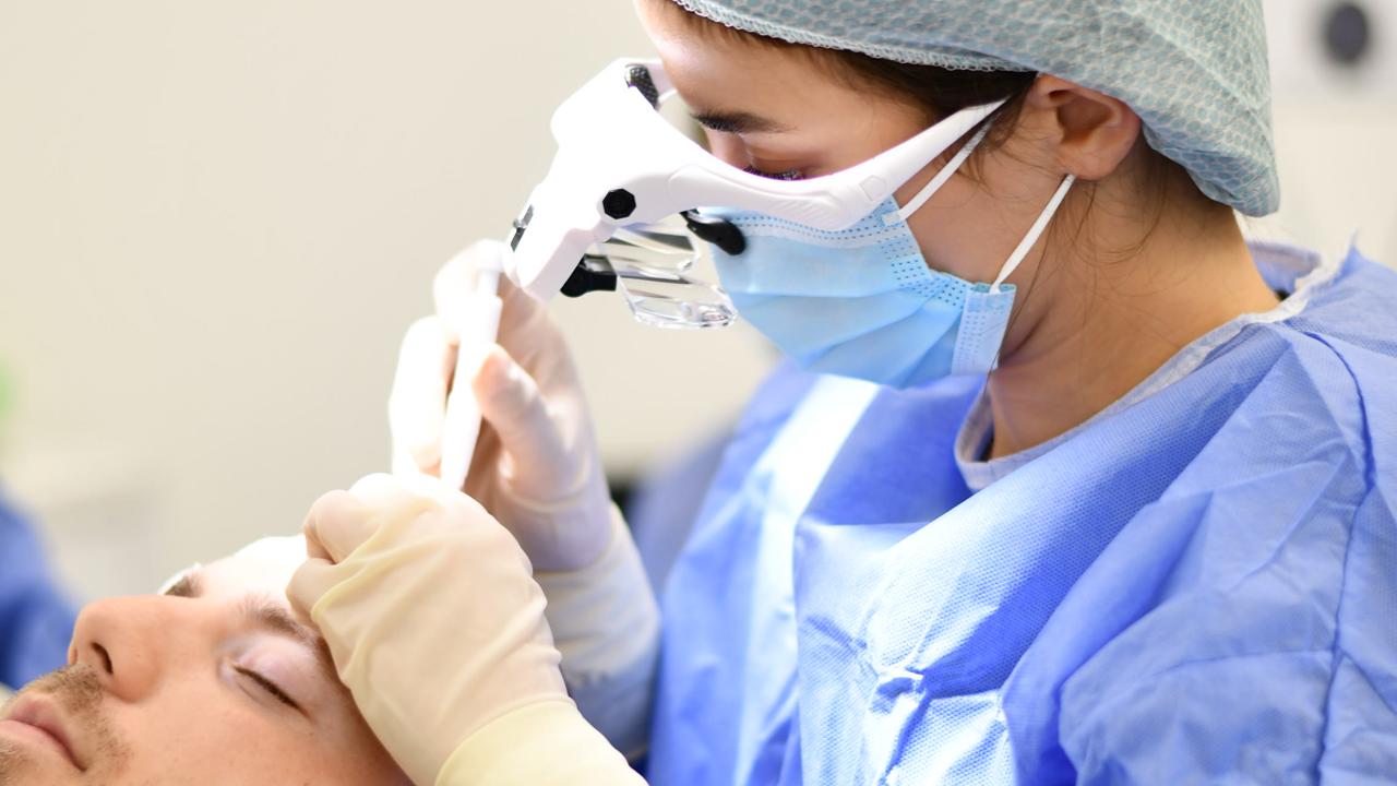 hoe werkt een haartransplantatie