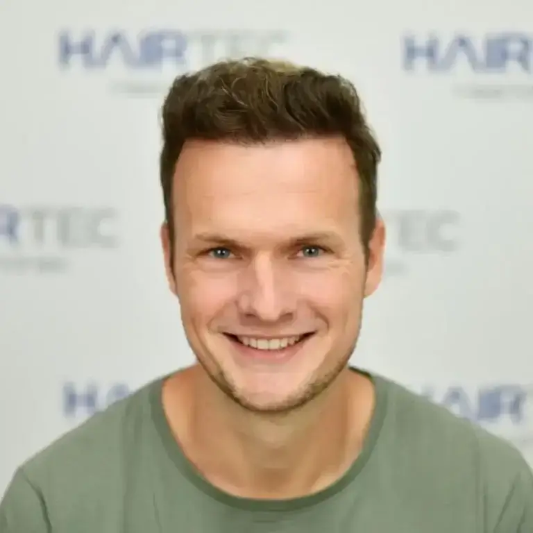 kevin voor en na foto resultaat