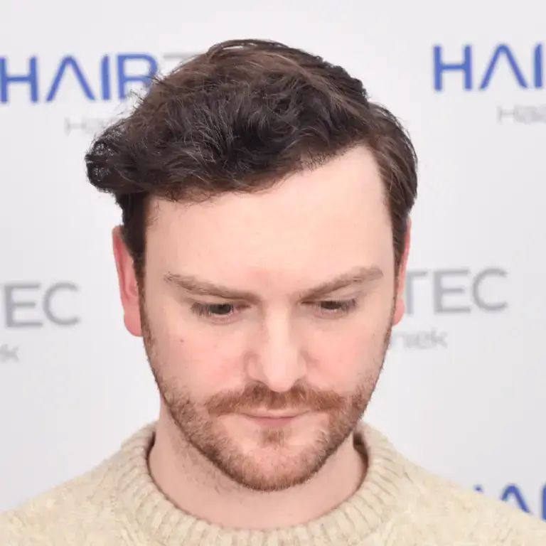 luke voor en na fotos na