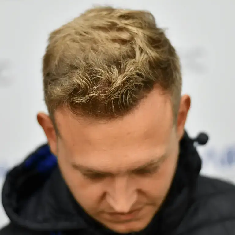 stefan voor en na photos na