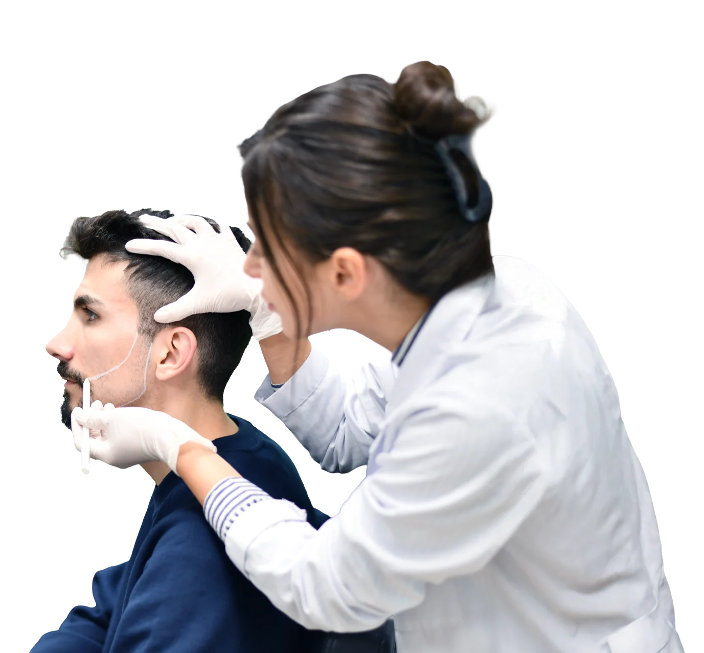 baard en snor transplantatie