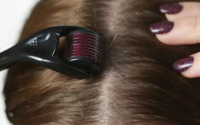 Werkt een dermaroller echt voor haargroei?