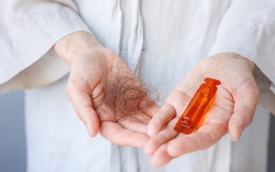 DHT en haaruitval & DHT blockers