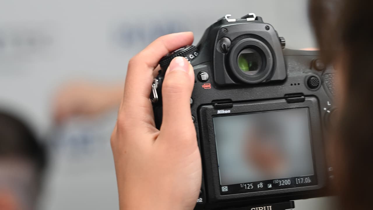 haartransplantatie controle dag