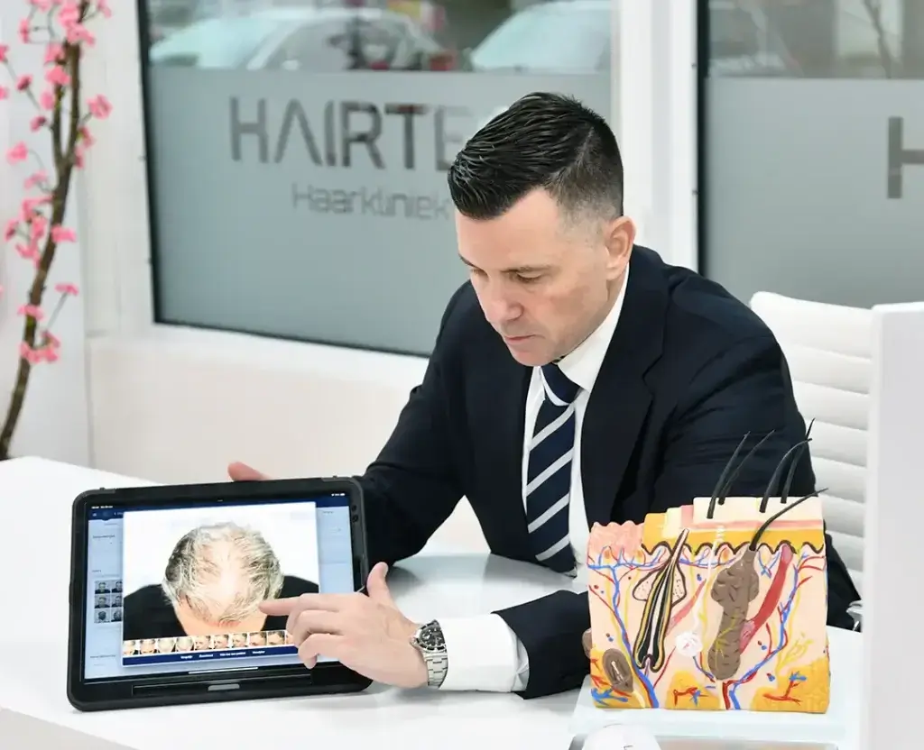 Medewerker van Hairtec wijst op een tablet met een foto van een kruin, naast een anatomisch model van de huid