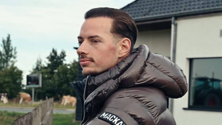 belgie haartransplantatie interview