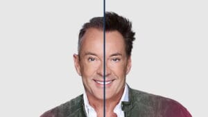 Haartransplantatie Gerard Joling: Wat weten we echt?