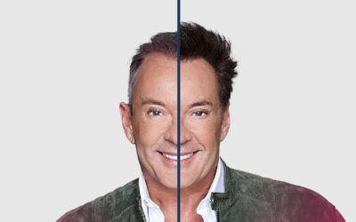 Haartransplantatie Gerard Joling: Wat weten we echt?
