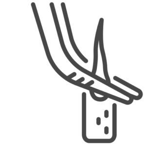 Directe implantatie van de haarzakjes