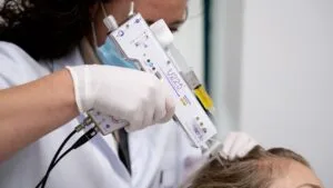 plasma behandeling haar