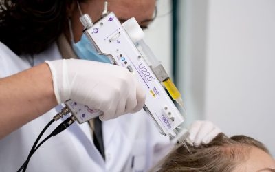 PRP behandeling voor haar & haarverbetering
