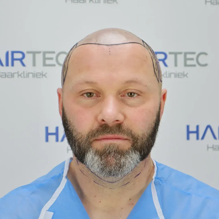 boerefijn voor behandeling