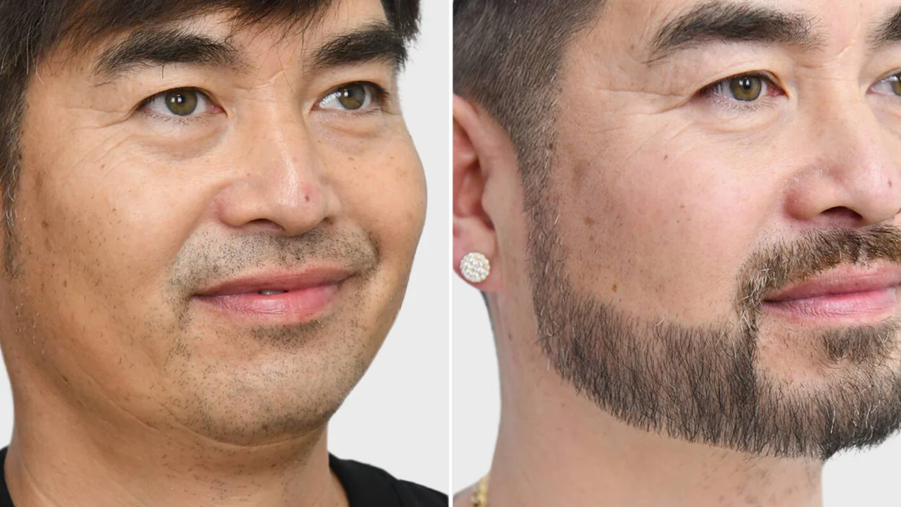 kenny voor en na rechts